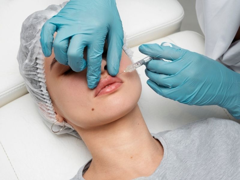 dudak-estetigi-ile-gulme-deformitesinin-duzeltilmesi