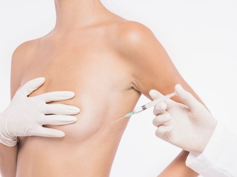 kimler-meme-yag-enjeksiyonu-yaptirabilir