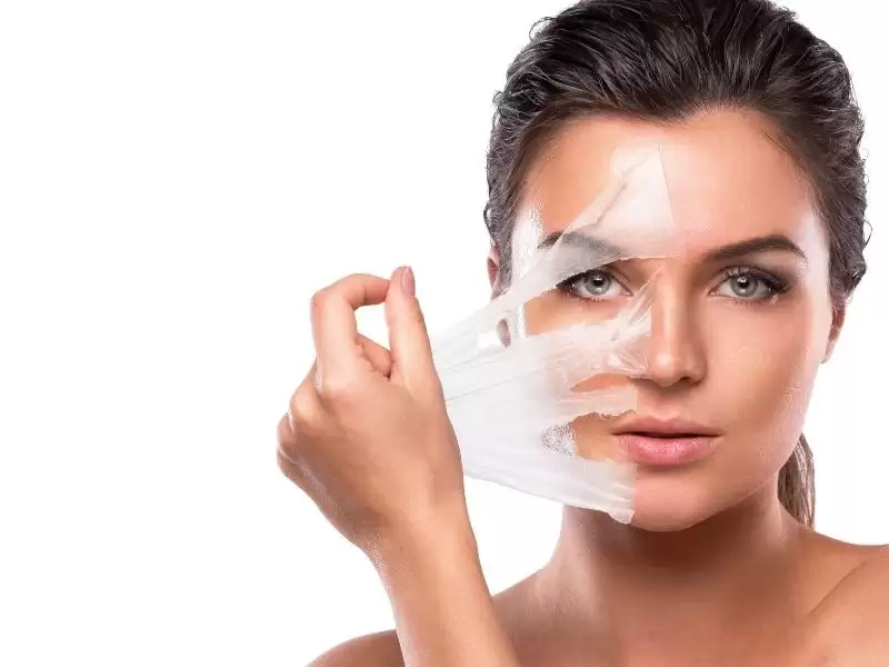 peeling-cilt-soyma-genclestirme