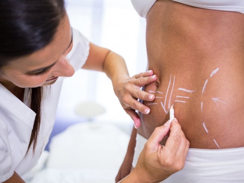 vucut-estetigi-yontemleri