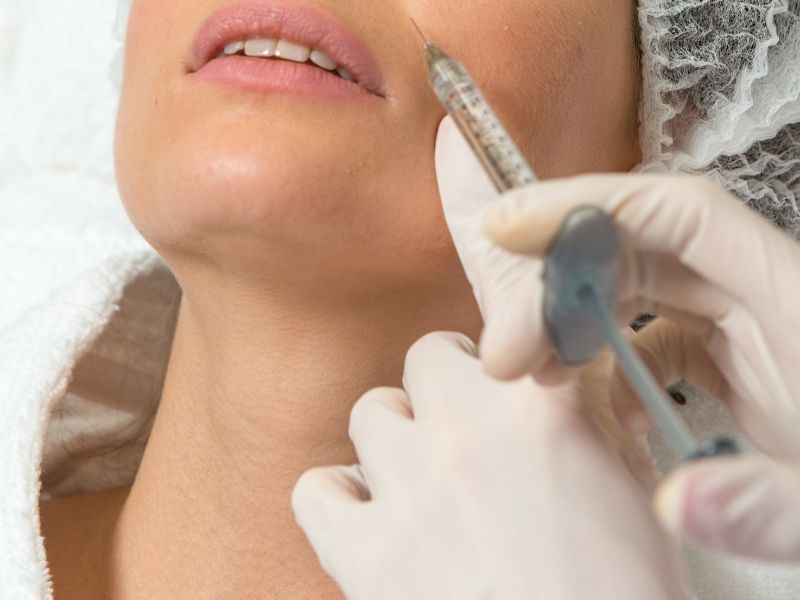 nazolabial-dolgu-kimler-icin-uygundur